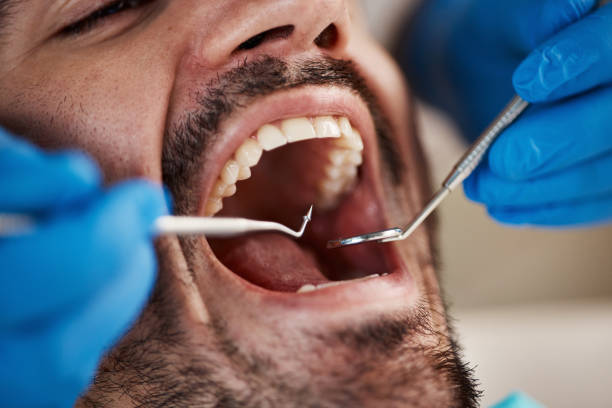 Best Emergency TMJ Treatment in Norwood, OH